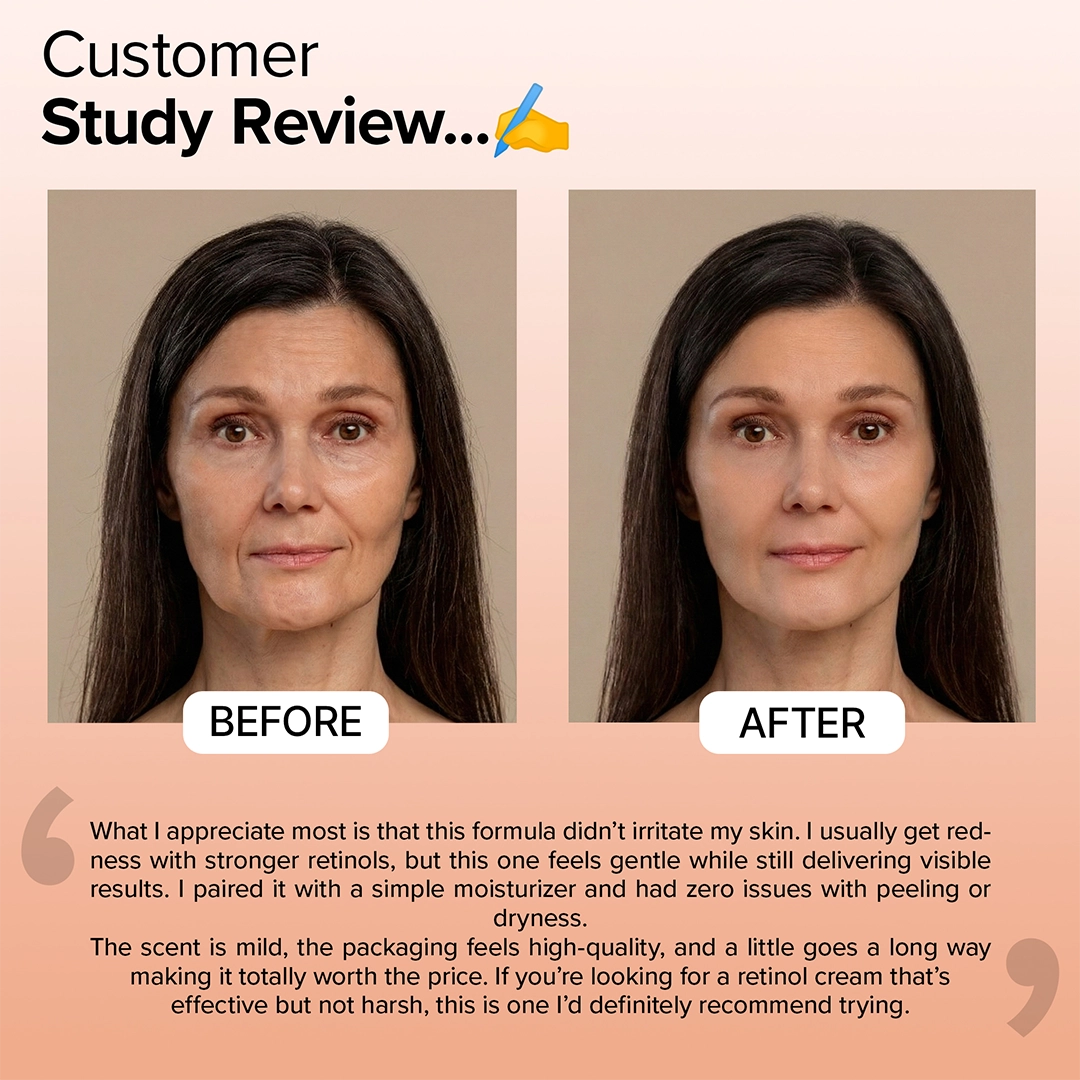 Retinol Capsule Cream