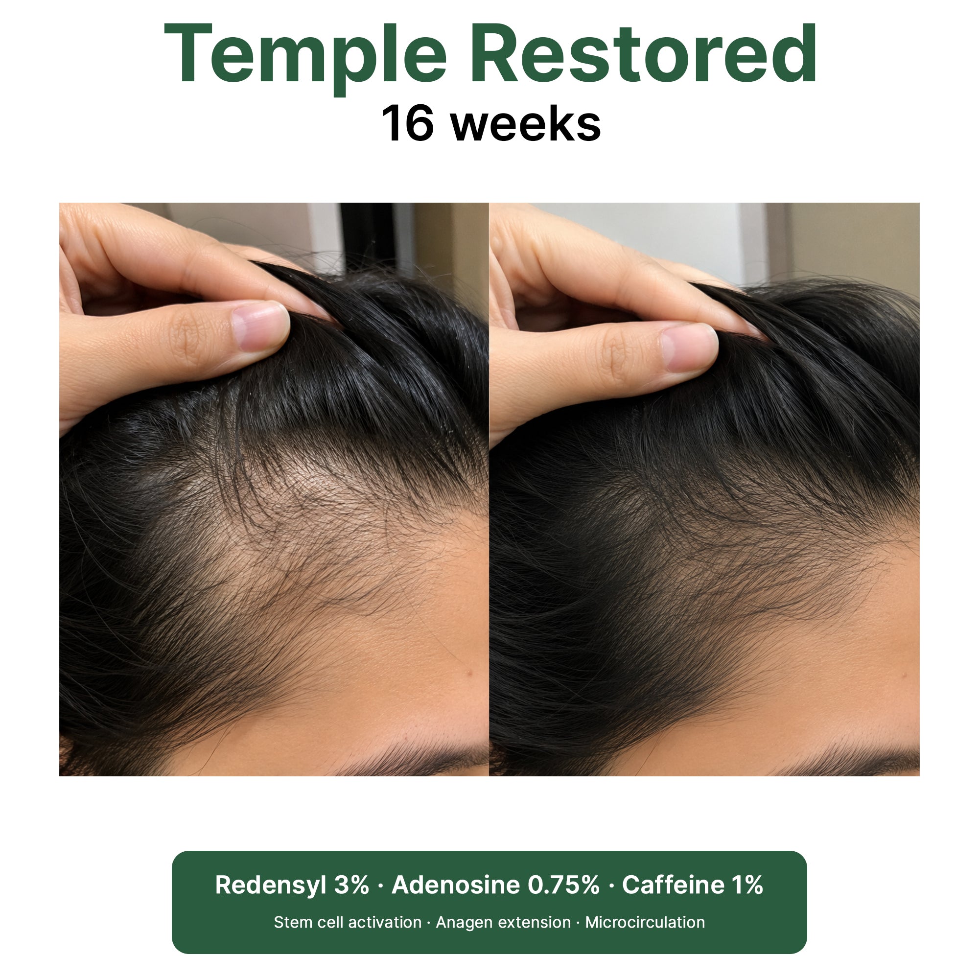 Rosemary + Peptides Hair Oil Serum