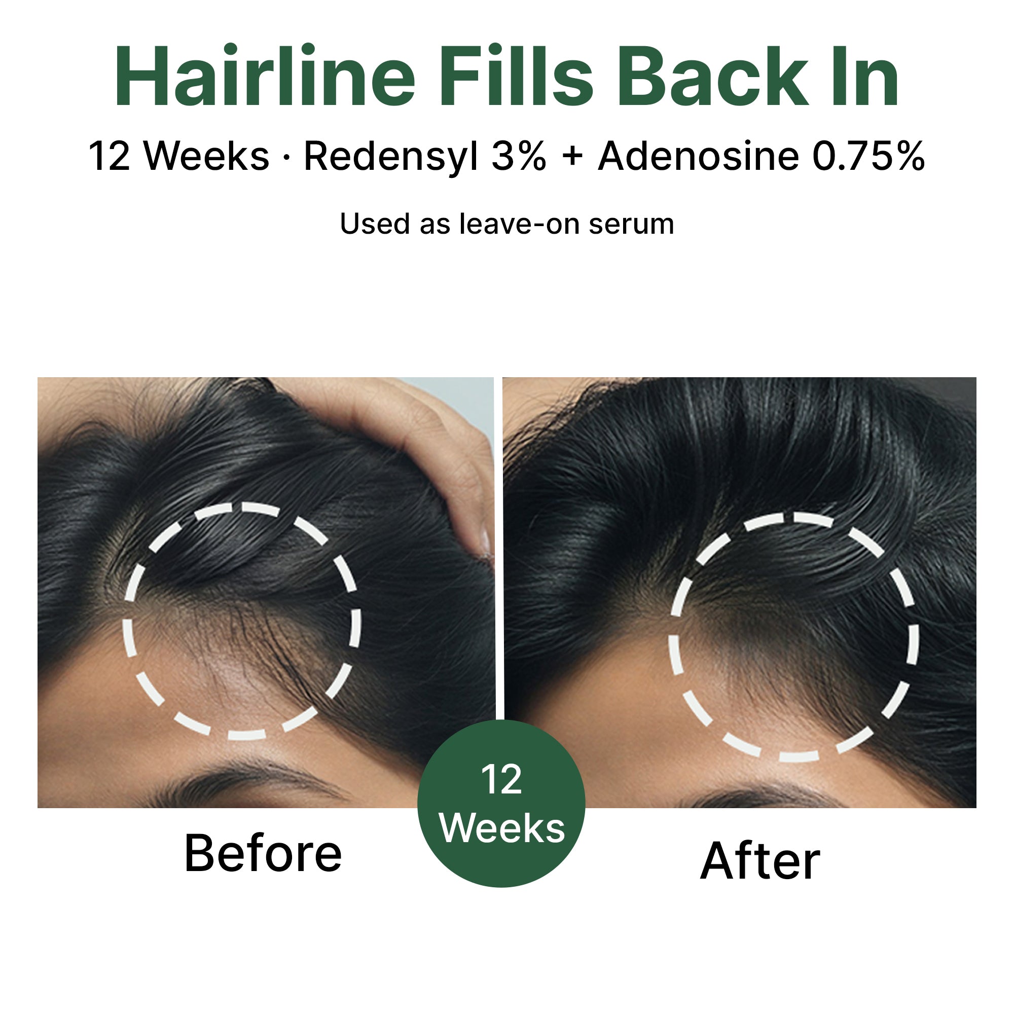 Rosemary + Peptides Hair Oil Serum