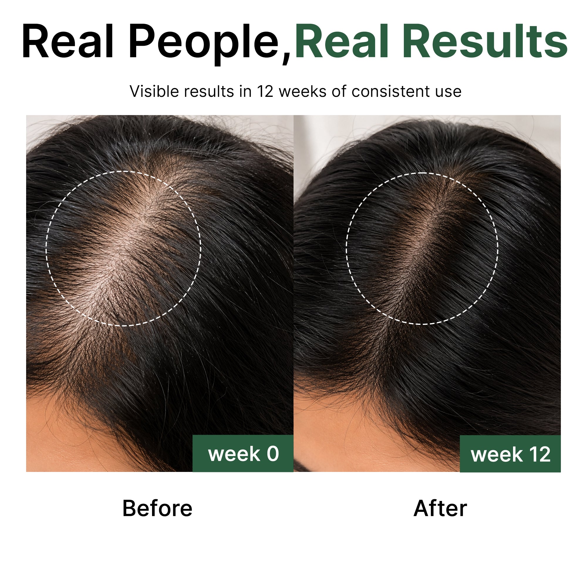 Rosemary + Peptides Hair Oil Serum