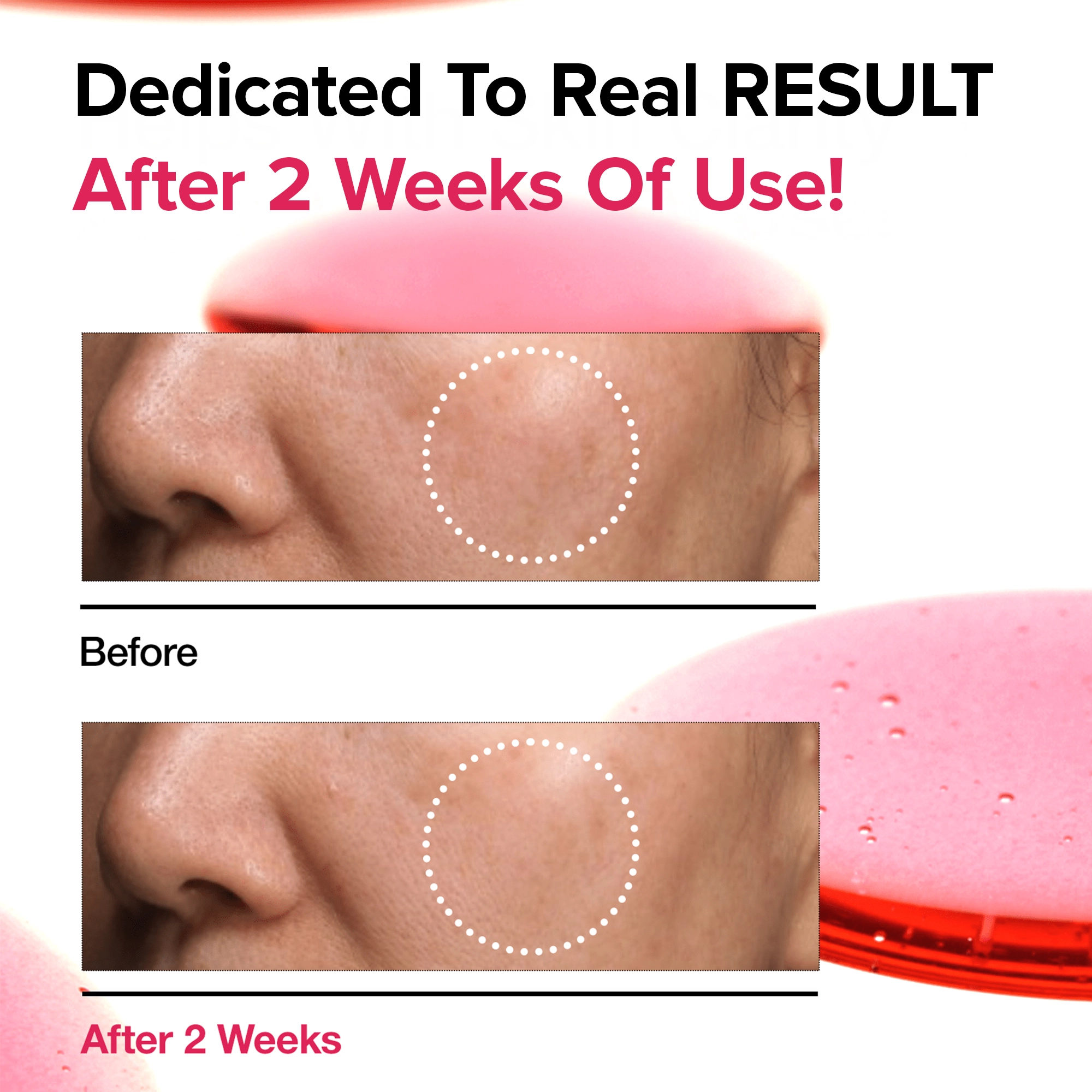 Essentive Dark Spot Correction Serum