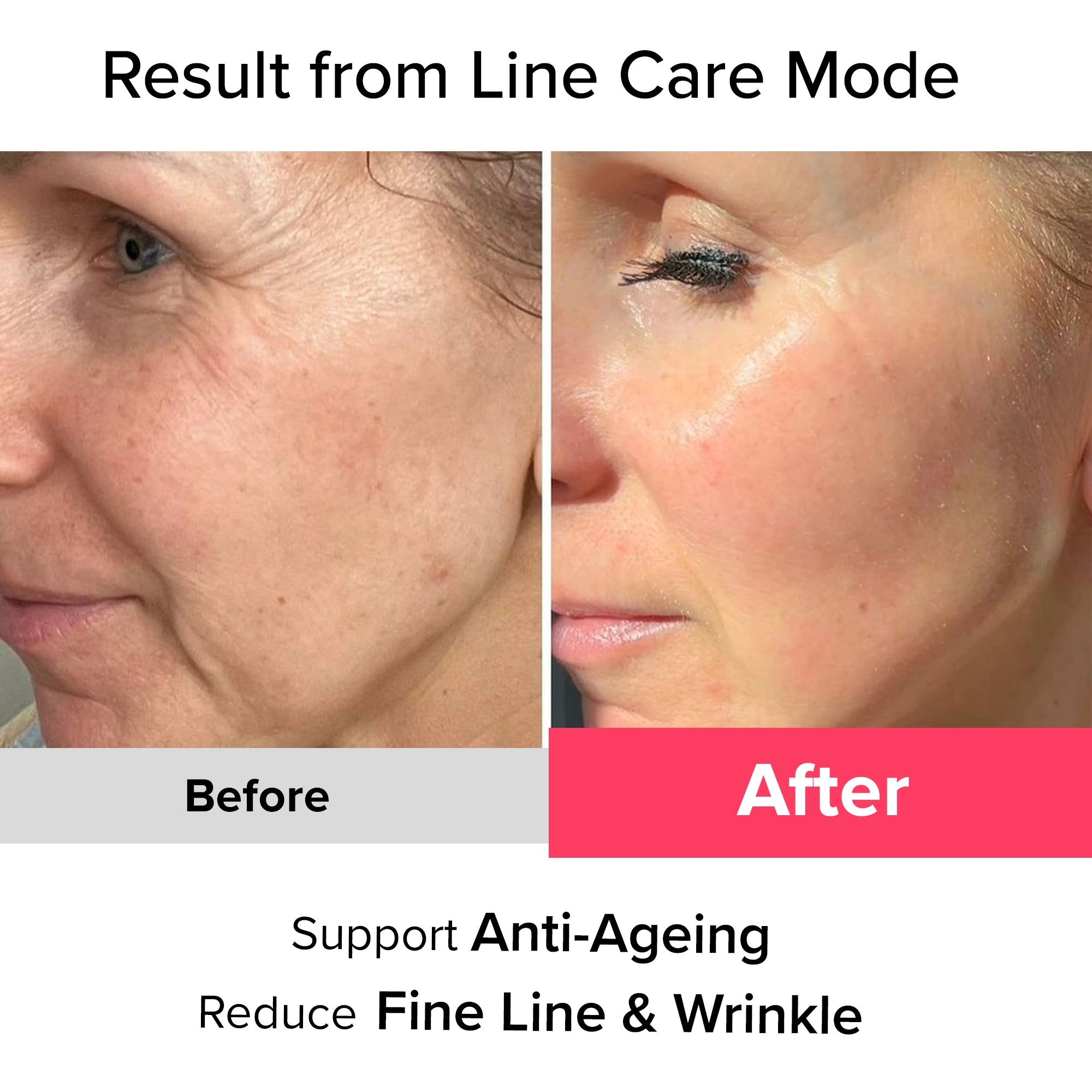 Essentive Beauty Elixir Pro