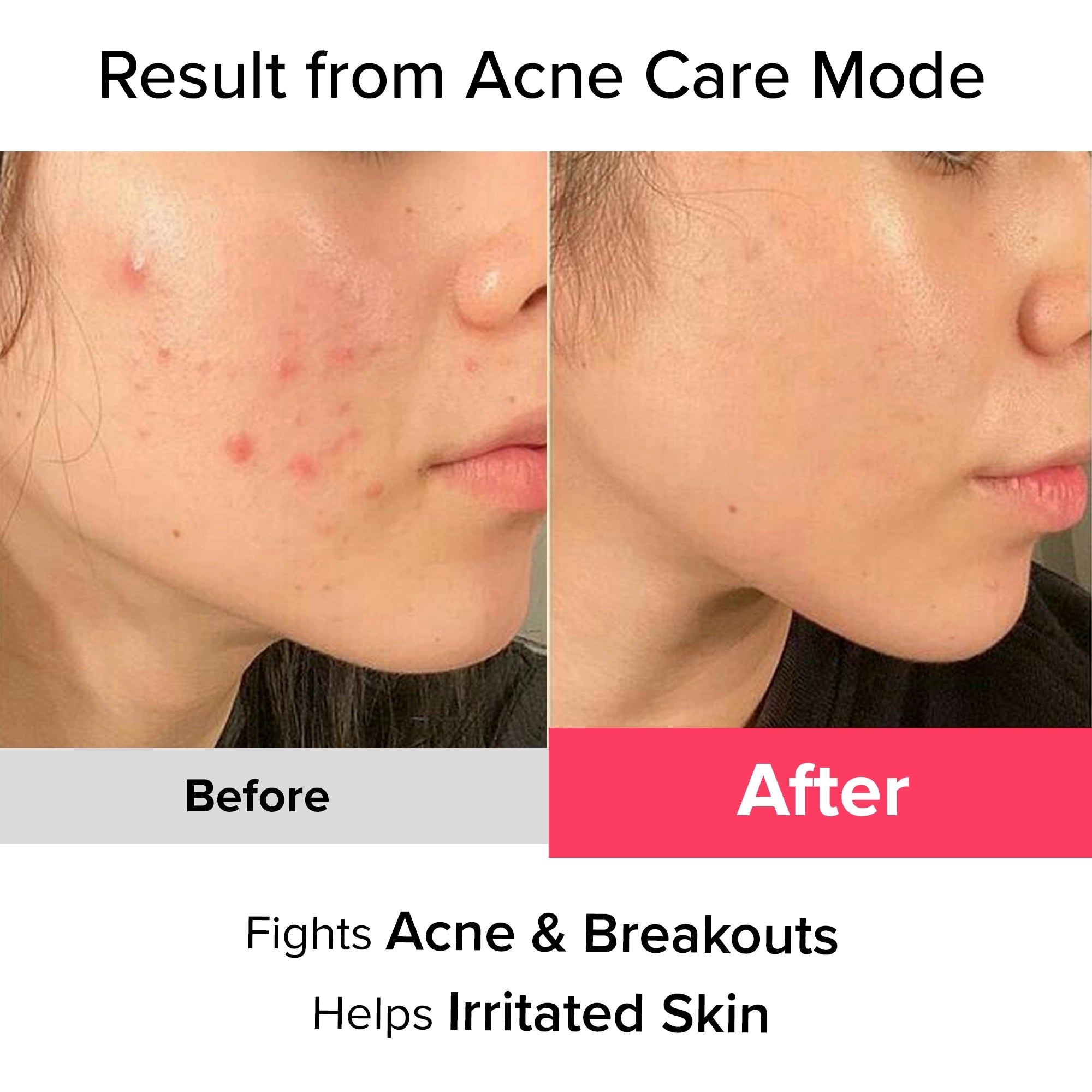 Essentive Beauty Elixir Pro